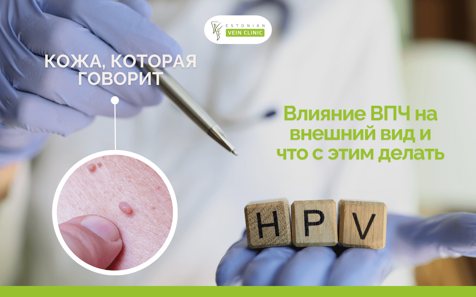 EstonianClinic общее баннеры (800 x 500 px) (7)