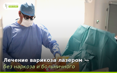 Лазерное лечение варикоза: обе ноги за один сеанс, без наркоза и больничного листа